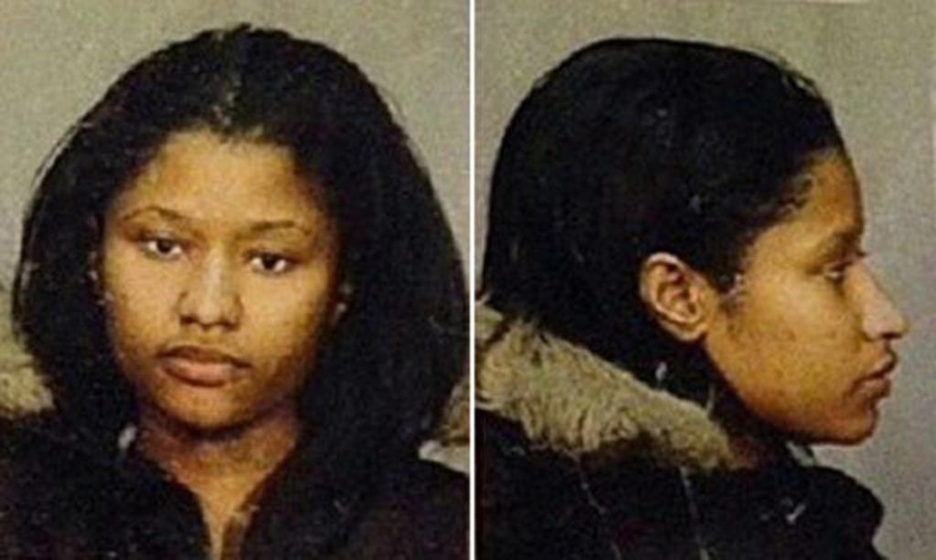 Nicki Minaj Before And After The Surgery